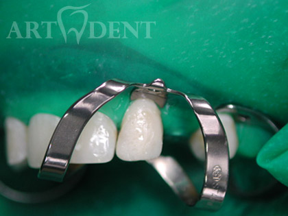 Art-Dent Стоматологический Центр