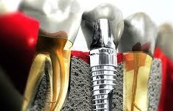 Стоматологический центр «Dent-Estet»