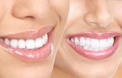 Стоматологическая клиника «Dental-Coral»