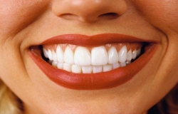 «Perfect Clasic-Dent»
